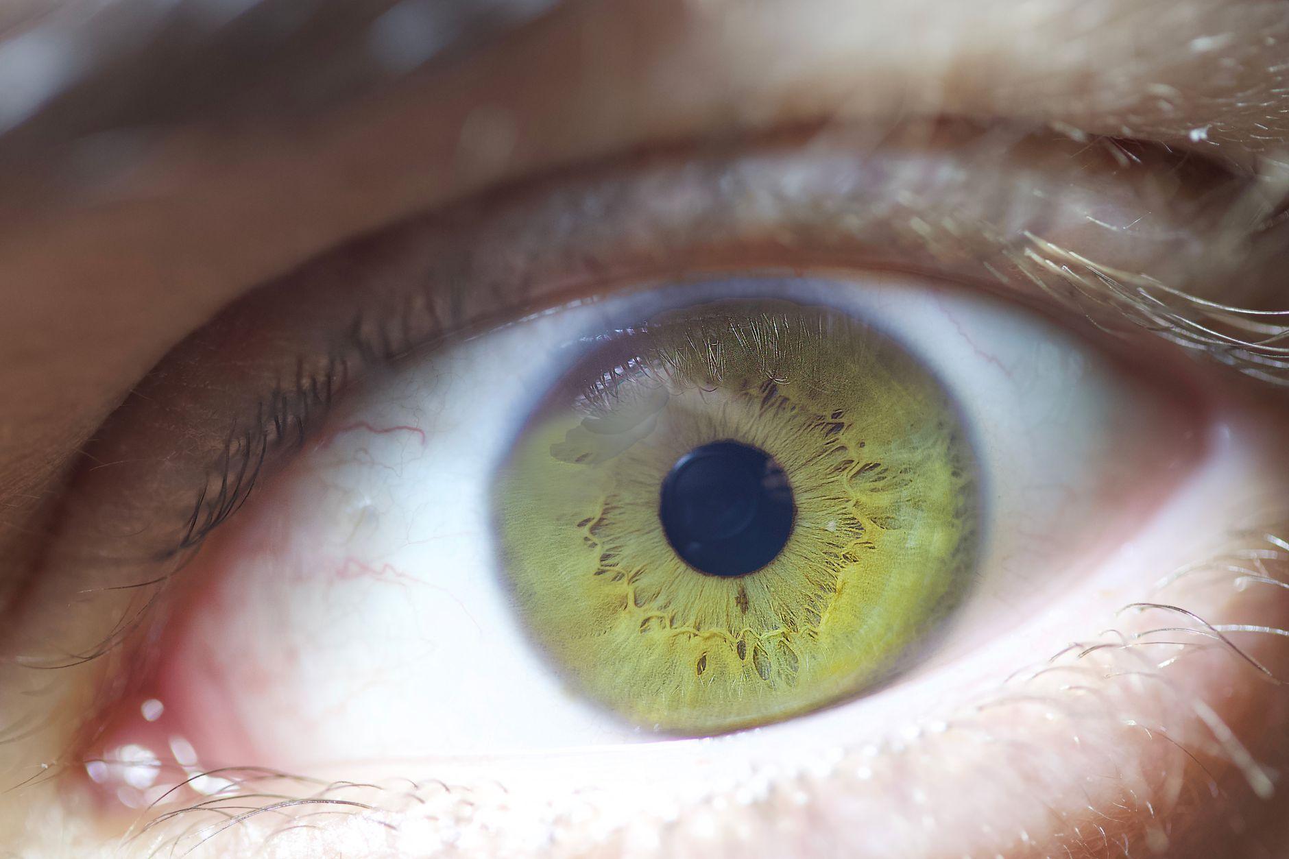 A close-up of a human eye, representing how eye color can be an indicator of potential disease risk.